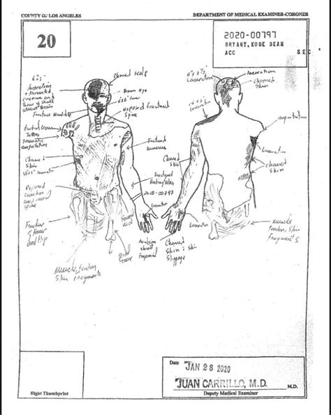 kobe and gigi autopsy picture|Kobe Bryant, Gigi Autopsy Sketch Photos Cause。